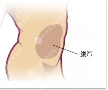 大便次数多是怎么回事